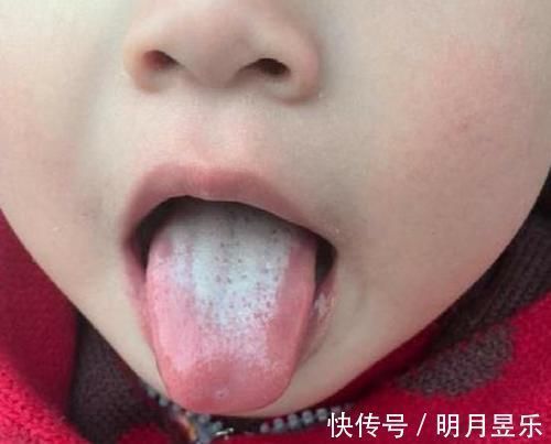 生长发育|10岁男童一年长高21厘米,妇幼主任:2种食物是“助长剂”,平常可多吃