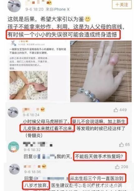 口水疹|郎朗晒娃又被批?这次冤枉!新手准爸妈还有哪些母婴常识需注意?
