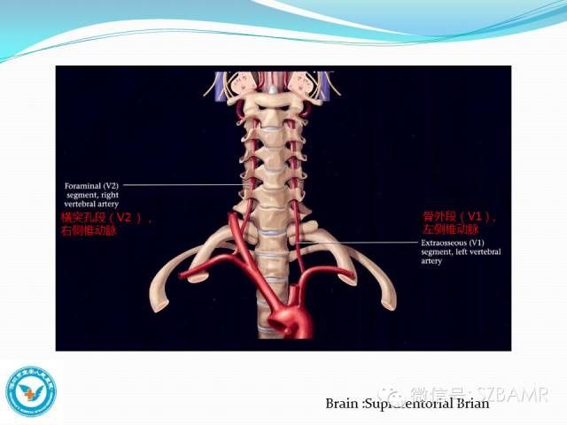 mr|椎-基底动脉系统解剖