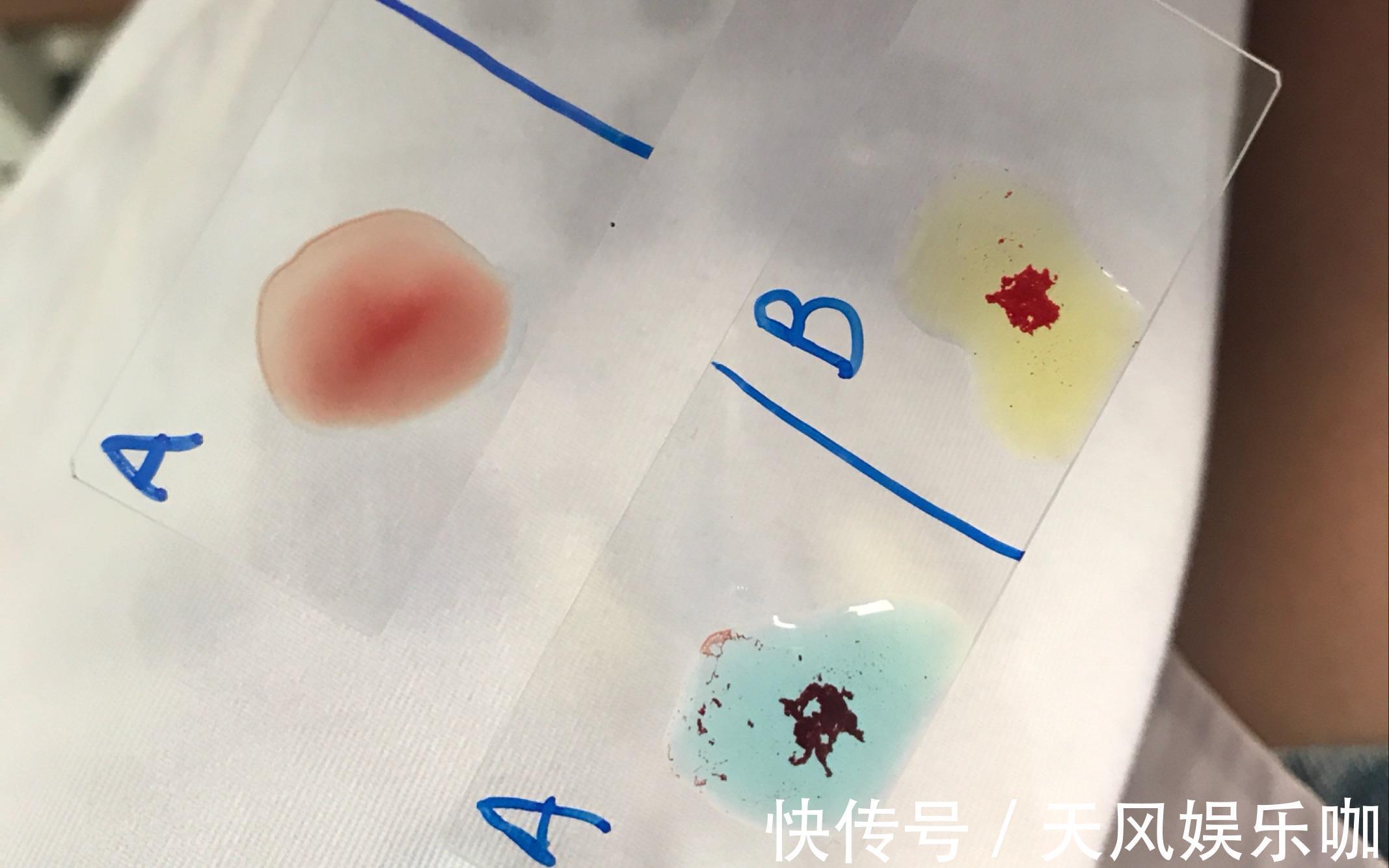 血型能决定“健康”和“寿命”?A型、B型、O型、AB型,哪种最好