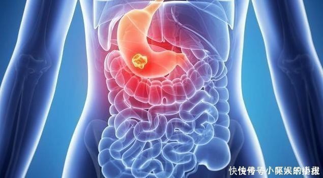 胃酸|消化科医生提醒:养胃不难,平时做好3件事,胃不酸疼,气色也好