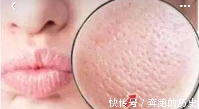 秘籍 毛孔粗大怎么办？护肤达人告诉你护肤秘籍，聪明的女人都在用