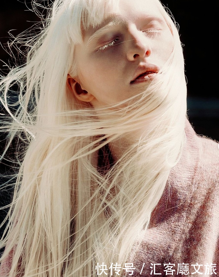 逆袭|因“全身雪白”被遗弃的中国女孩,逆袭成超模的故事让人泪目