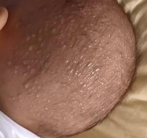 脾胃|5岁男娃脾胃衰竭,2年不长个,妇幼主任:3种“毒早餐”害了娃