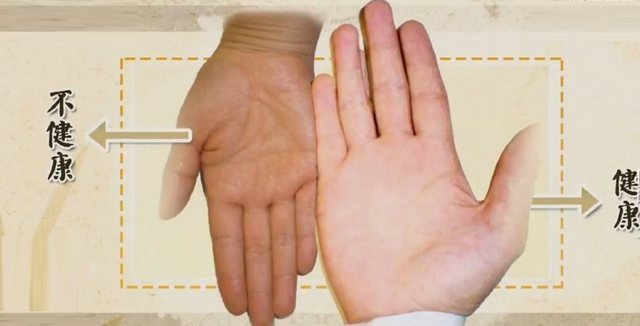 血糖|身体里的血糖高不高，伸出手掌便知晓，为健康一起了解下