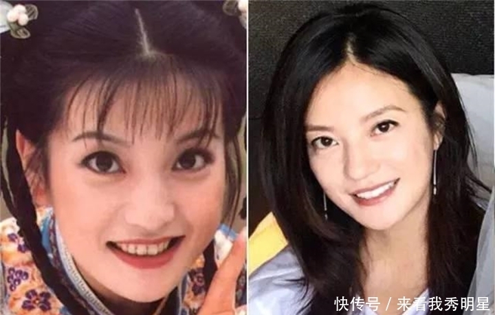 眼是美之窗,鼻是颜之魂;范芳医生谈国人常见鼻型及美学特点一