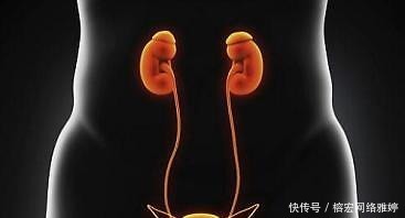 结石会|很多人碎完肾结石之后,还是感觉到很疼,这个时候应该怎么办?