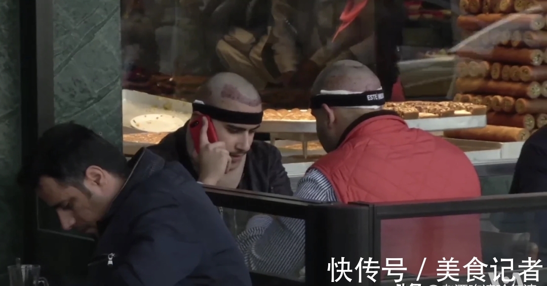 chris 每个月到底有多少人去土耳其植发?