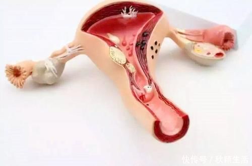 第三产程|胎儿那么大,怎么就从那个小口出来了,看完泪奔:妈妈太伟大了