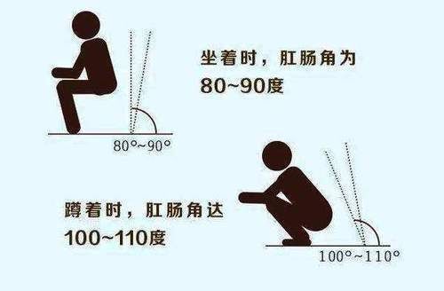 姿势|便秘和大便姿势有关系？换个姿势大便更畅通