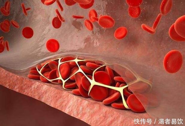  拯救|血管一旦堵塞，身体会发出3个“求救信号”，做好3件事拯救血管