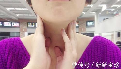 甲状腺结节|甲状腺出现结节后,要避开几种食物,再爱吃也要忍住