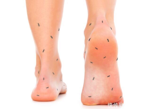 Éý¸ß|ÌÇÄò²¡»¼Õߣ¬ÉíÌå³öÏÖÕâ5¸ö±íÏÖ£¬´ú±íѪÌÇÉý¸ß£¬¾¯ÌèÉñ¾²¡±ä