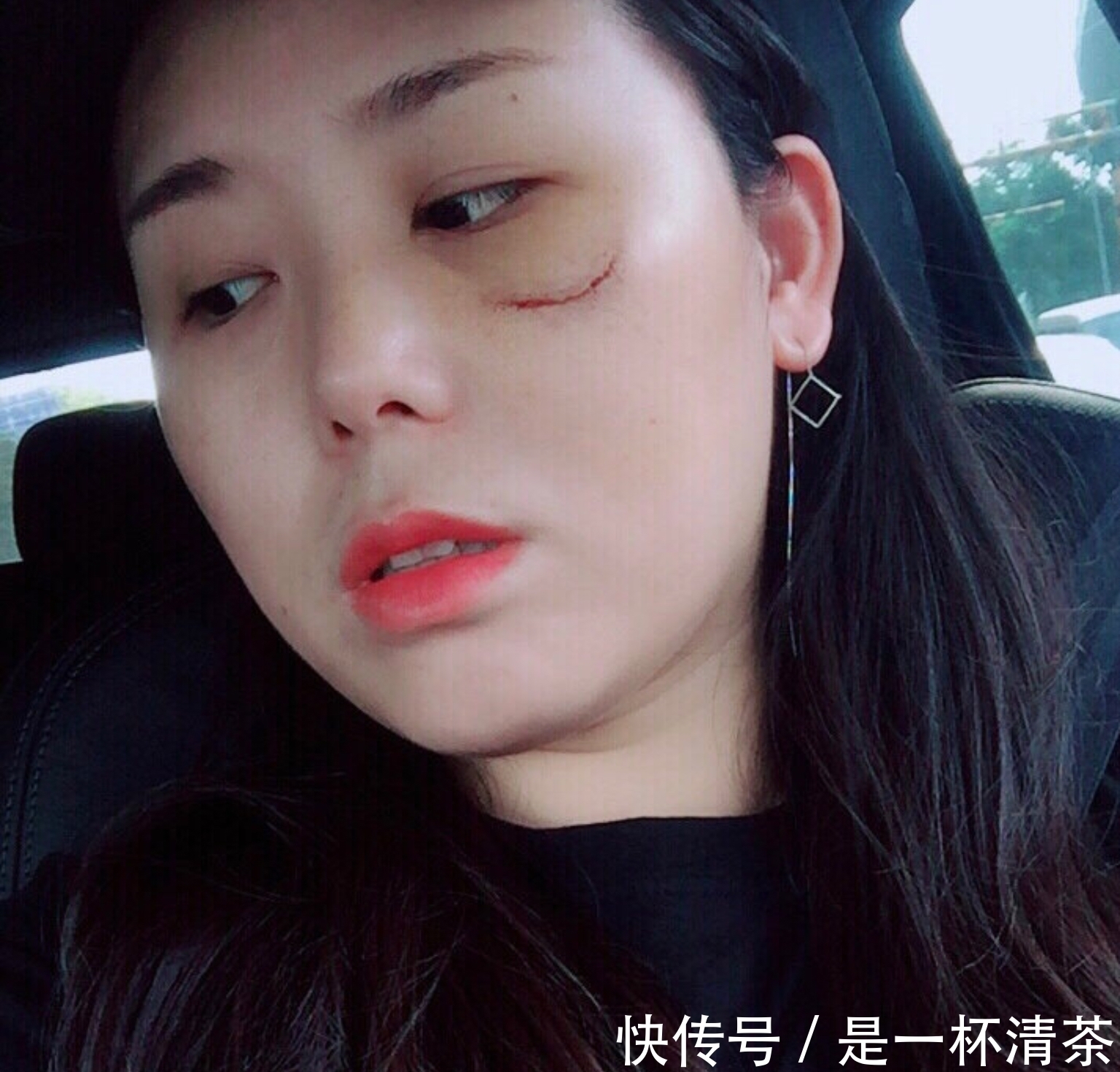 女人 脸上有这四个特征的女人,用护肤品易“烂脸”,中三个以上快停用