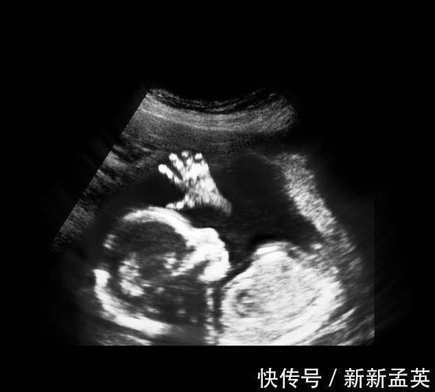 胚胎|胎儿从卵泡到性别形成,17张图片清晰诠释,男宝女宝看得很清楚