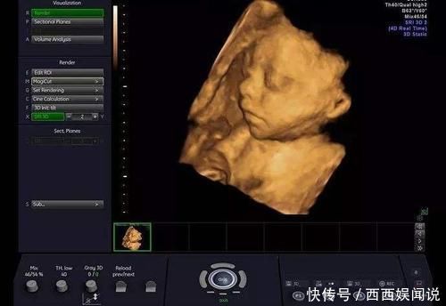 产检|怀孕40周做十多次产检都有必要吗?四项产检认真做,关乎胎儿健康