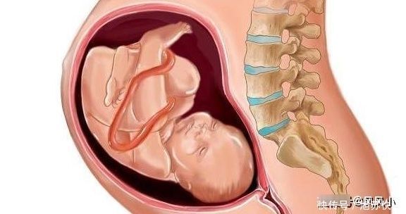 分娩|分娩时,这3种产妇宫口开得快,即使占一个,顺产时会少受很多罪