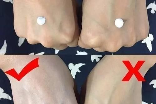 晒伤|宝妈忘给孩子做防晒,早起带娃去海边玩,晚上带回俩“国际友人”