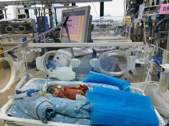兄妹俩|100多个日夜的精心守护 超早产双胎宝宝闯过生命关卡