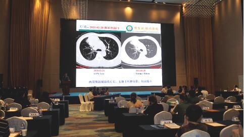 肺癌多学科联合委员会|山东省医学会成功举办肺癌多学科联合委员会规范化诊疗培训班（第四期）