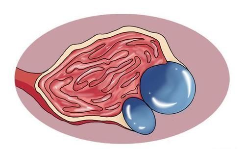 晚期|体检年年不落,为什么还是查出癌症晚期?医生毫不隐瞒说出真相