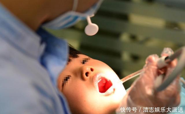 孩子被鱼刺卡喉怎么办吞饭、喂醋纯属害娃,正确做法就两步