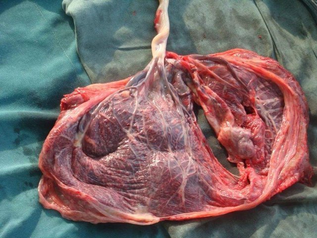 判断|胎盘是否老化怎么判断？关系胎儿发育的关键，孕妈不可大意