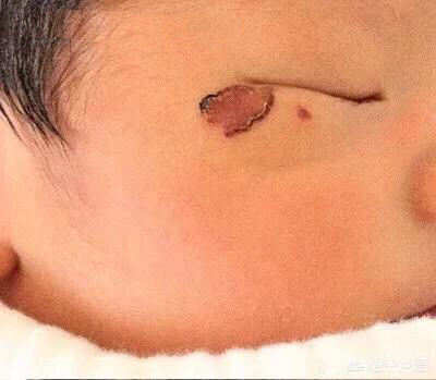 宝宝|女子发现宝宝脸有镰刀痕,去医院医生告知不是病,看完监控报了警