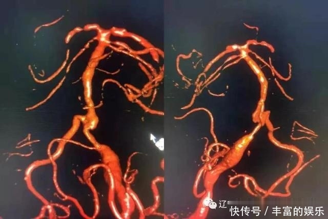 醒来|7岁男孩突然昏迷,醒来后说“妈妈,我要抱抱”