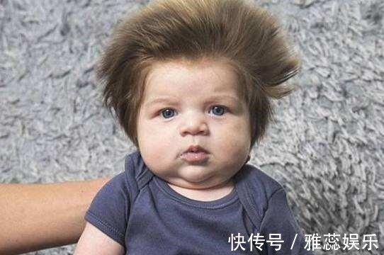 父母|宝宝头发总是“竖着长”可能是营养不足,这3个原因妈妈要分清