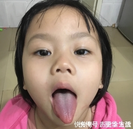 脾胃|补脾“状元”已找到,平常让孩子敞开吃,积食没了,免疫力也强了