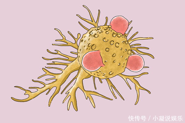 对照|不容易得癌症的人,都是哪些人身上有什么特征对照一下