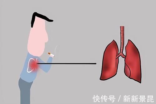 肺部|这三种香烟或已进“黑名单”,经常抽烟的人要注意,最好别抽了