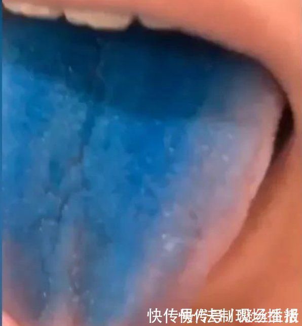 食品|网红蛋糕化身“染色剂”,舌头被染蓝洗不掉,食品安全太操心