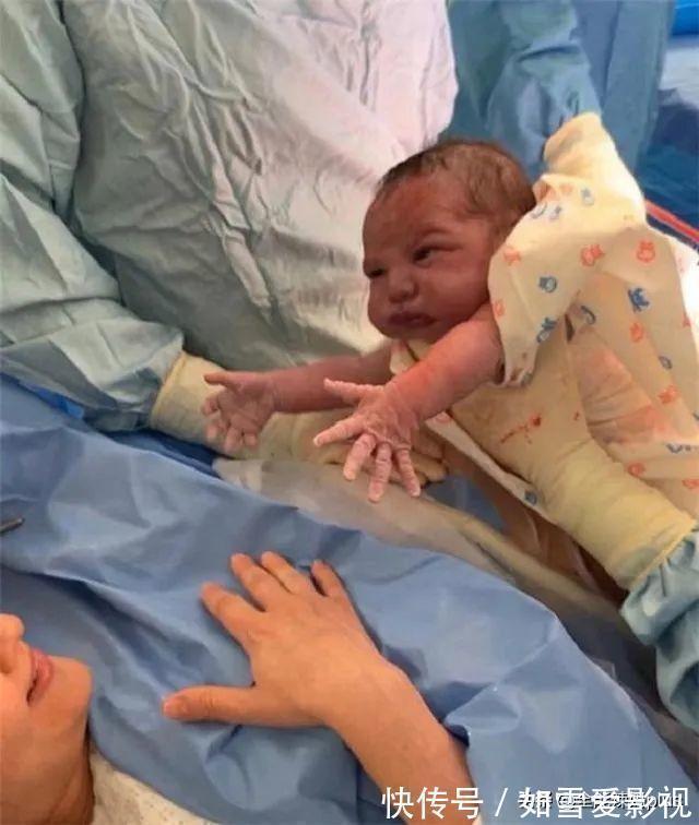 乐翻|最“社会”宝宝:自带“迎接仪式”出生,大场面“乐翻”医生