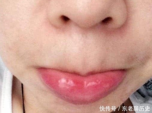 唇妆|学生党“贼伤嘴巴”的3动作,多数00后已中招,变“火锅嘴”可别哭