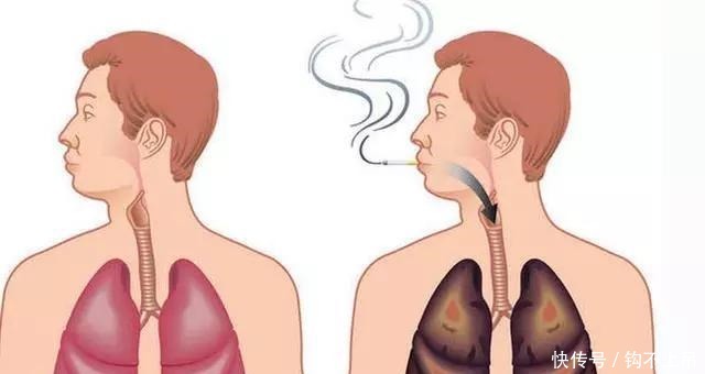 健康|戒烟会造成这样的不健康倾向, 但同样是一个好的现象!