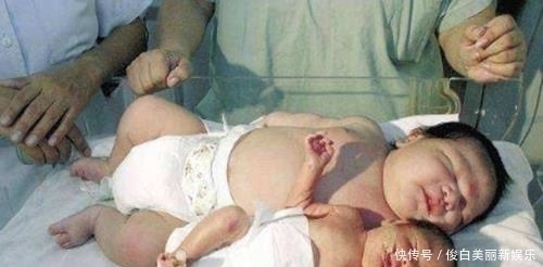 产妇|产妇生下龙凤胎，哥哥吃奶粉，妹妹吃母乳，6个月后差距太大