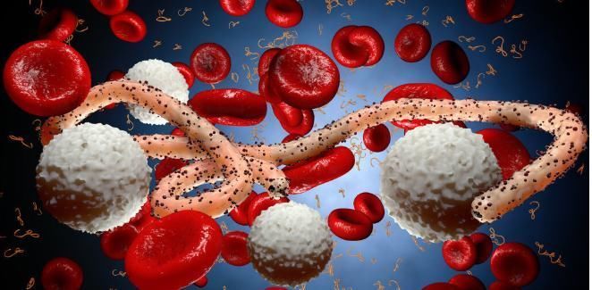 全身|癌症高发?担心自己得了癌?医生告诉你:一个检查,便可检查全身