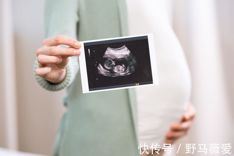 精神状态|孕妇羊水质量好不好，看这3个表现就行，全中的可以放心养胎了