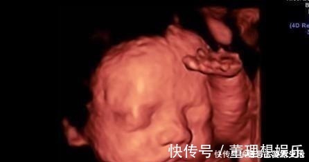 b超|孕期做四维有什么好处,什么时候做最好这个时候做是最好的