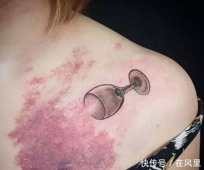 当丑陋的疤痕,遇上纹身师的智慧,原来疤痕也可以变得很美