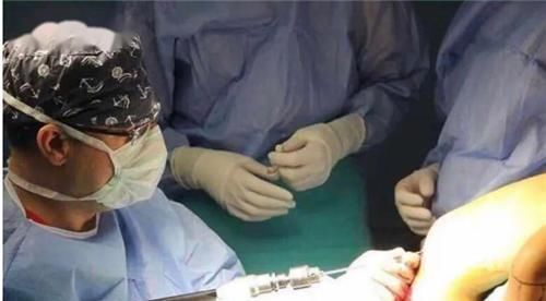 学生|高三学生因身高矮小自卑,花16万断骨增高7.2厘米,如今怎样?