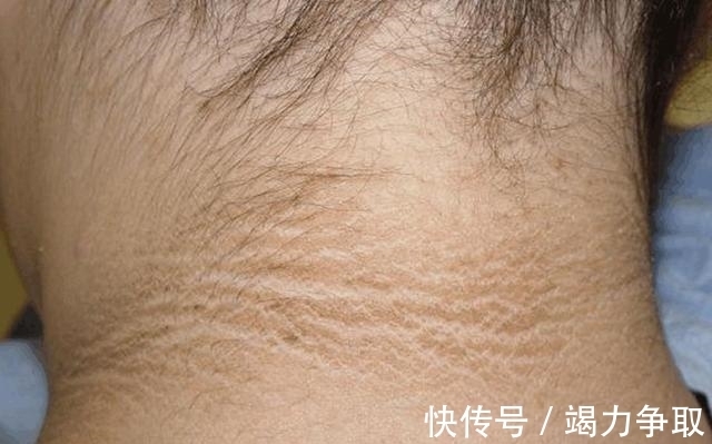 摩尔|好消息:2021新血糖标准已公布,4.0~6.1或不再适用,看一下