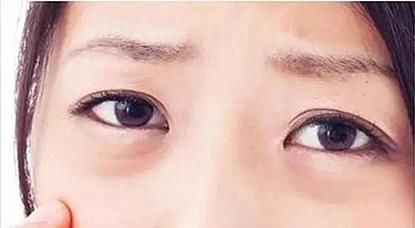 别拿眼袋当卧蚕，眼袋正在毁掉你的颜值！