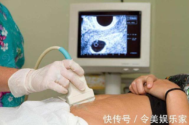 畸形|孕期孕妈最多能做几次B超超过此上限,会给女宝带来一大隐伤