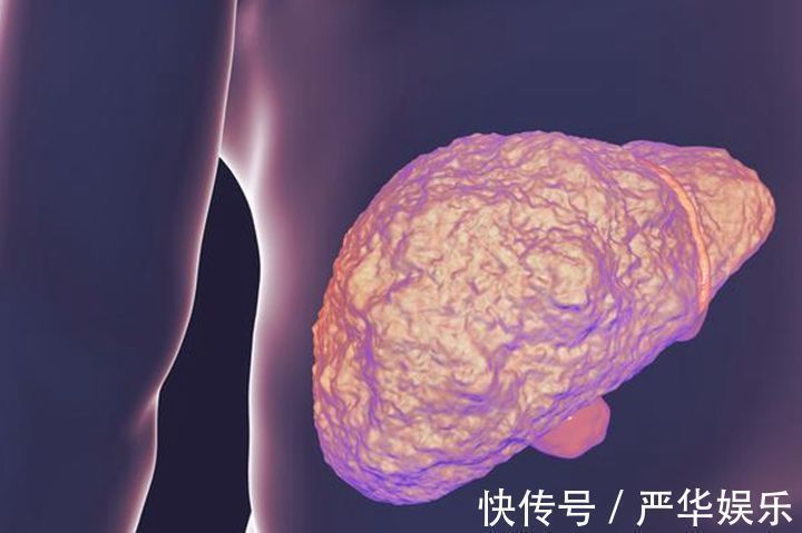 肝细胞|此物被称为“肝脏化毒王”，没事吃两口，肝硬化会自动退却！