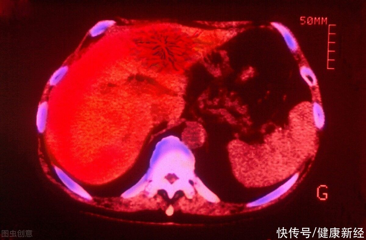 腹泻|提醒：1种水果尽量远离，否则“肝脏”会遭殃，不少人还当做宝