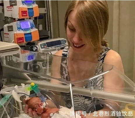 周生|准妈妈孕24周生下1斤4两宝宝 现健康回家;父母做法令人感动