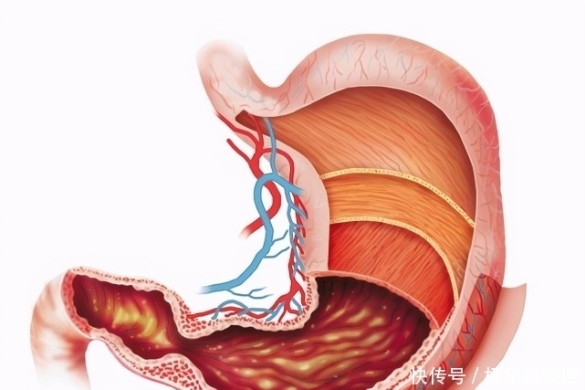 胃不好的人，饭后容易出现3种表现，占一个，最好检查一下